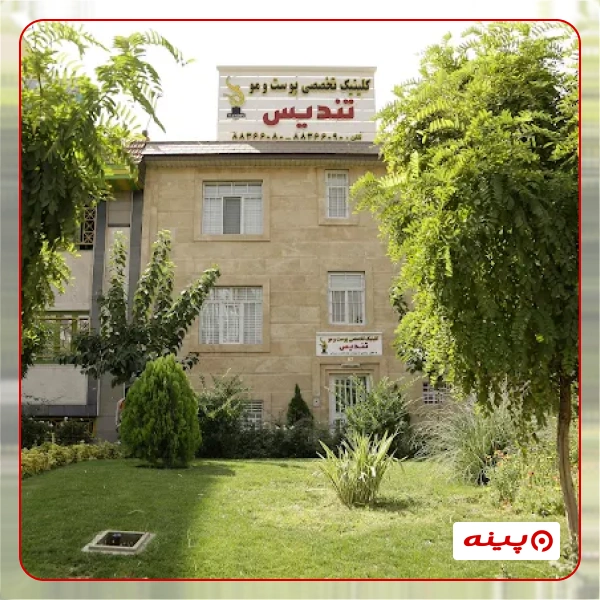 کلینیک زیبایی تندیس 
