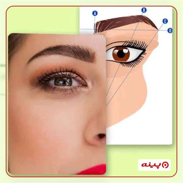 کاشت مو آدنیس